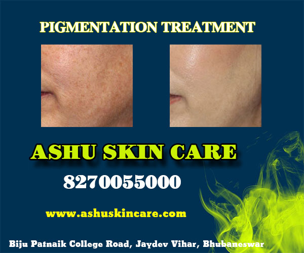 best pigmentation treatment clinic in bhubaneswar near me